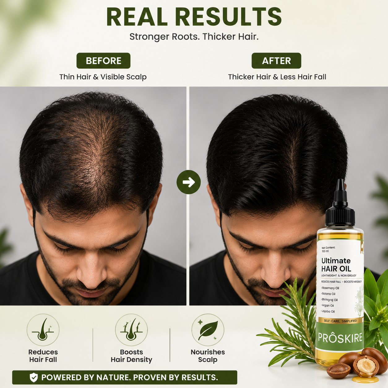 🌿 Ultimate Hair Growth Oil – Rosemary & Batana Hair Care Oil