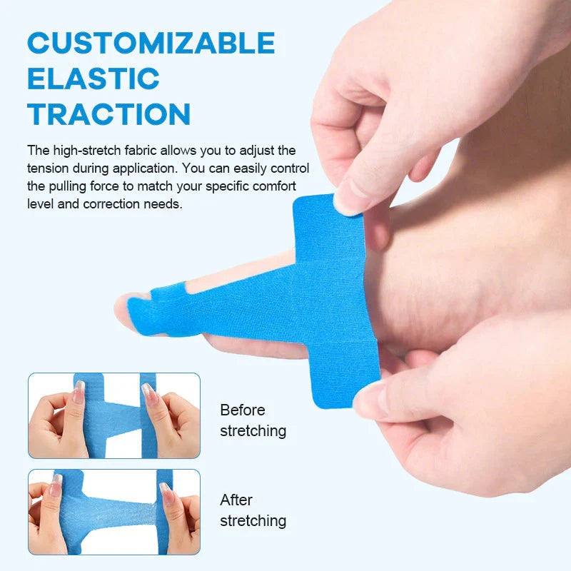 Pre-cut  Big Toe Corrector Strips