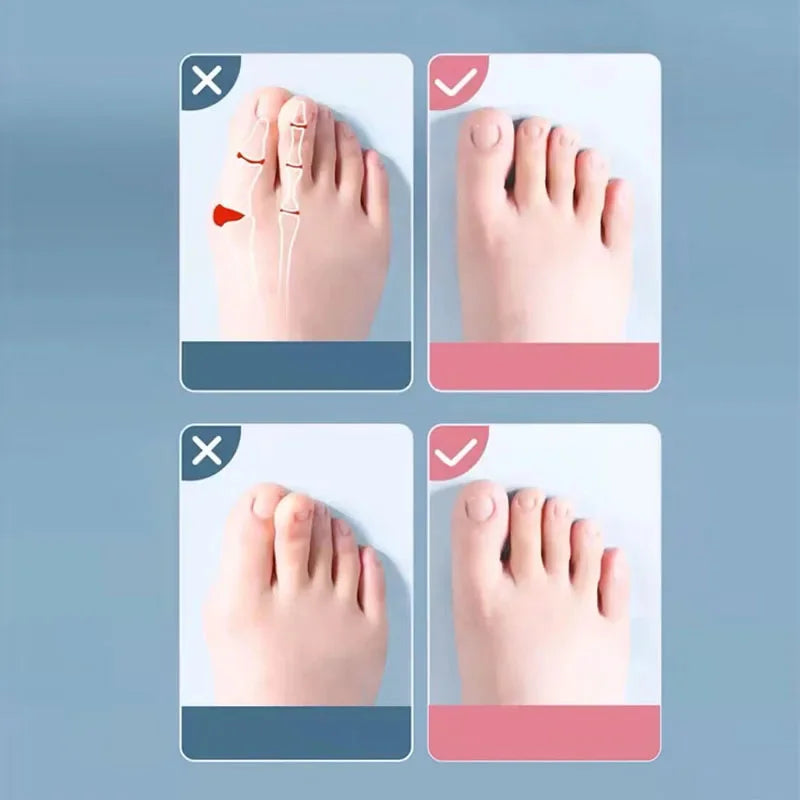 Soft Silicone Toe Separator & Foot Corrector