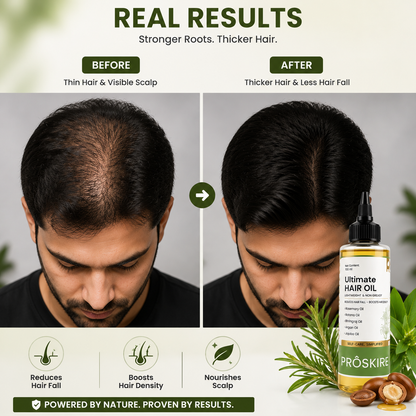 🌿 Ultimate Hair Growth Oil – Rosemary & Batana Hair Care Oil