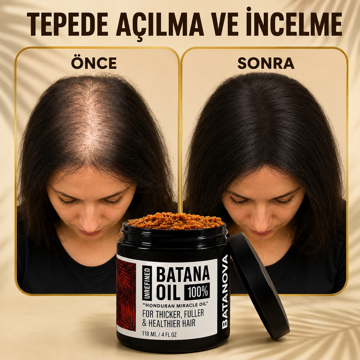 Batana Re-Growth Hair Oil
