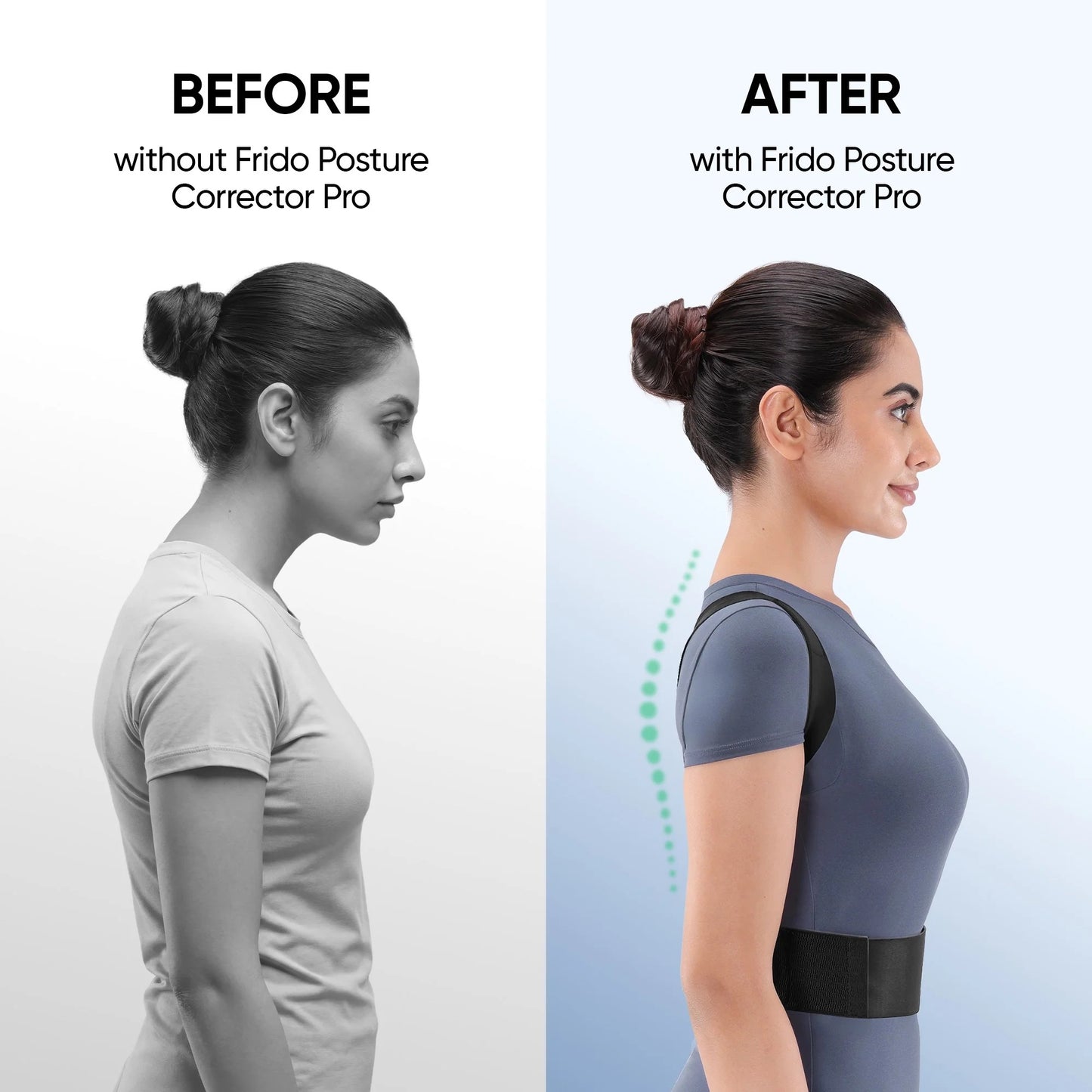 Frido Orthotics Posture Corrector