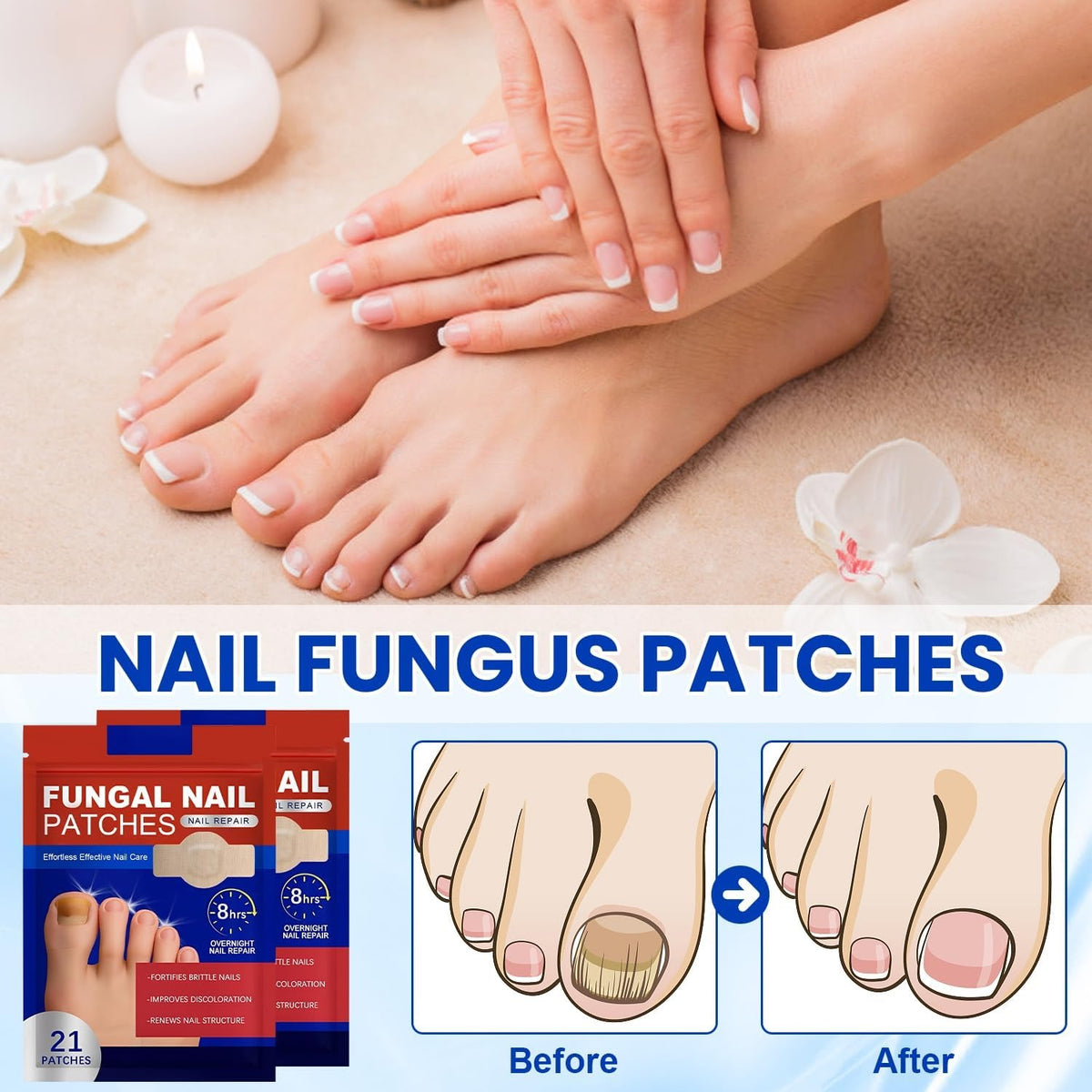 Fungal Nail Patches