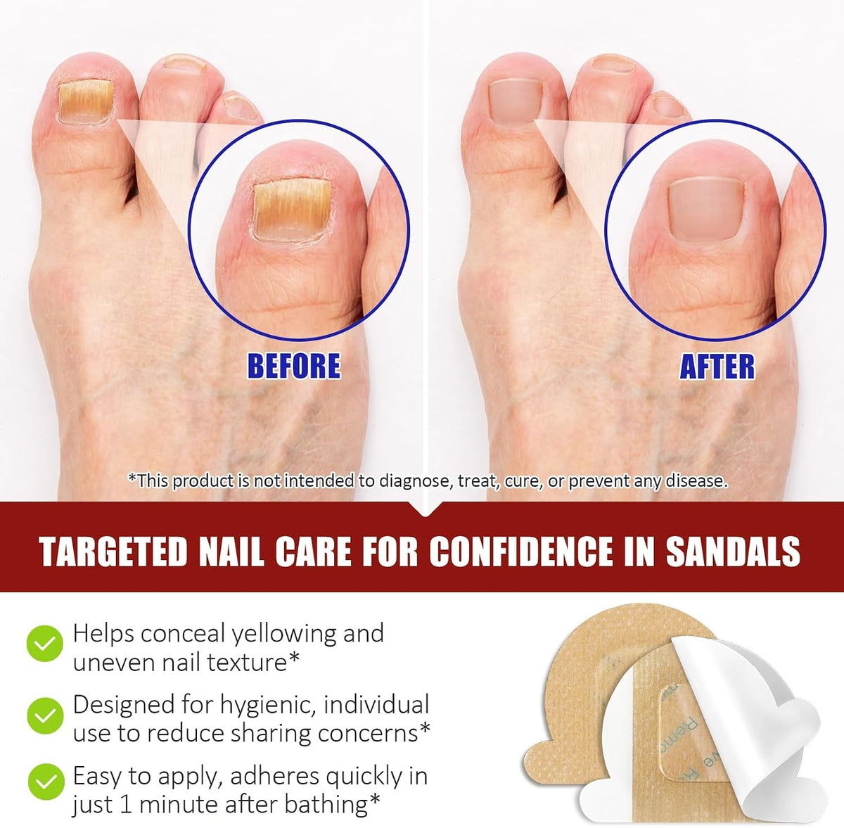 Fungal Nail Patches