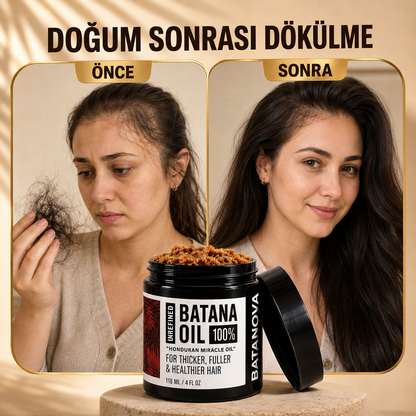 Batana Re-Growth Hair Oil